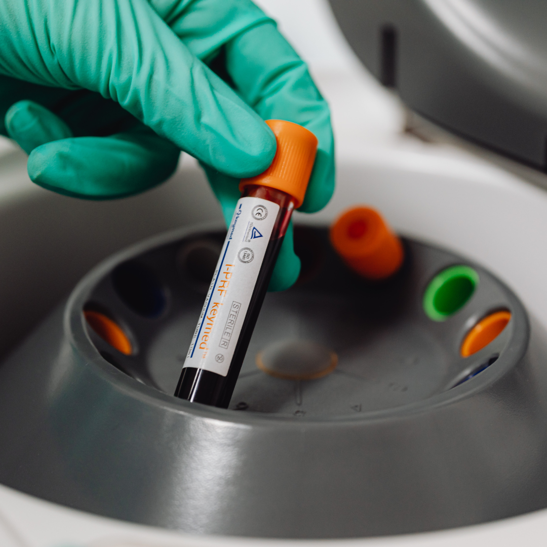Tubos vacutainer